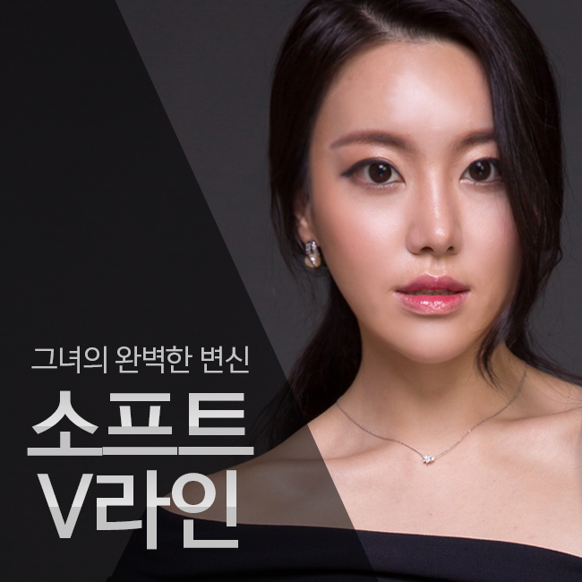 심술보제거는 역시 김형진뉴라인! 관련 이미지 1