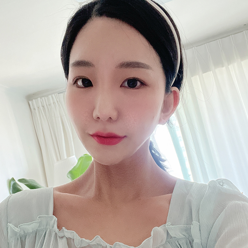 입꼬리필러효과 아직 모르신다구요? 관련 이미지 3