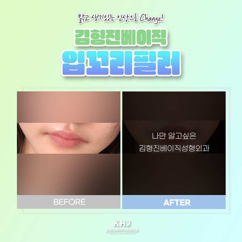 입꼬리올리는법 궁금하셨죠? 관련 이미지 3