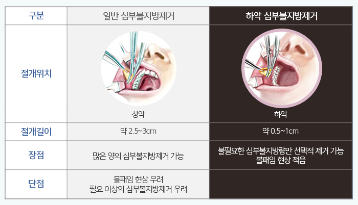 볼씹힘 심하다면, 이게 해결책! 관련 이미지 4