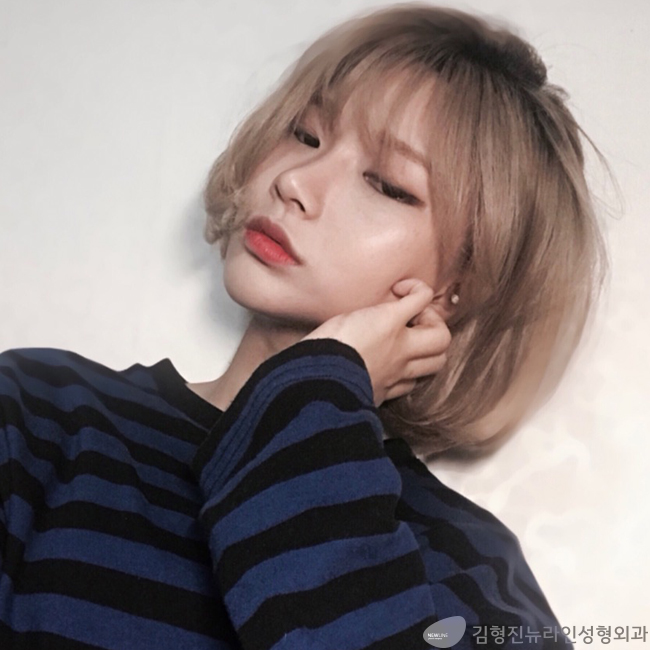 지방이식잘하는곳 여기에요!~ 관련 이미지 1