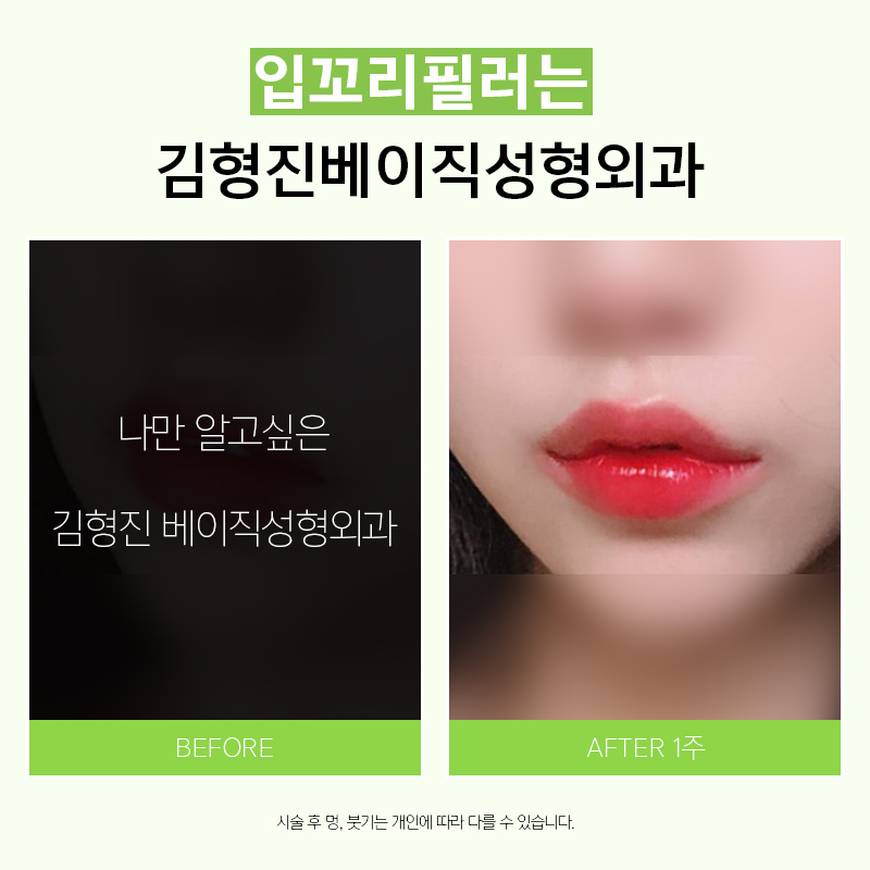 예쁜입술 되는방법, 별거없어요! 관련 이미지 3