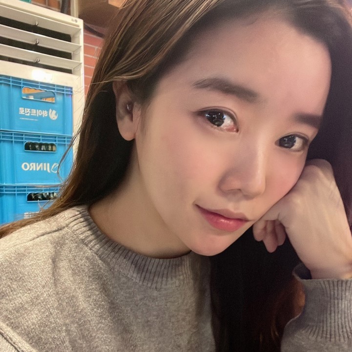 믿을만한 눈밑지방재배치병원 찾고있다면 관련 이미지 3