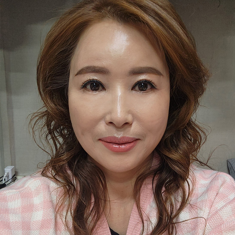 미니하안검효과 궁금하셨다구요? 관련 이미지 1