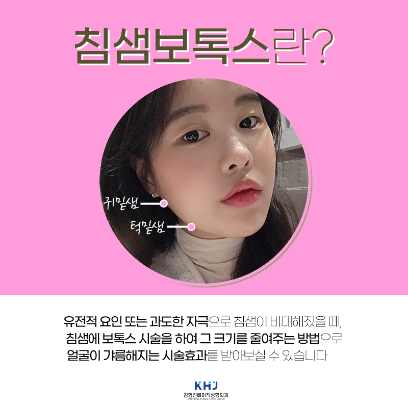 침샘보톡스시술로 숨어있던 턱라인 찾았어요ㅠㅠ 관련 이미지 4