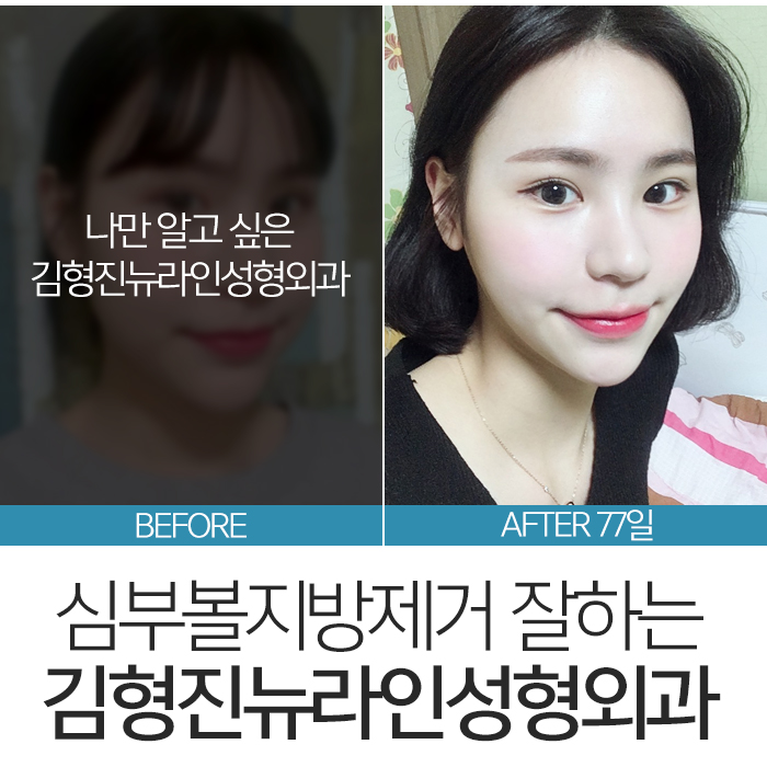 심부볼위치 정확하게 요기 관련 이미지 2