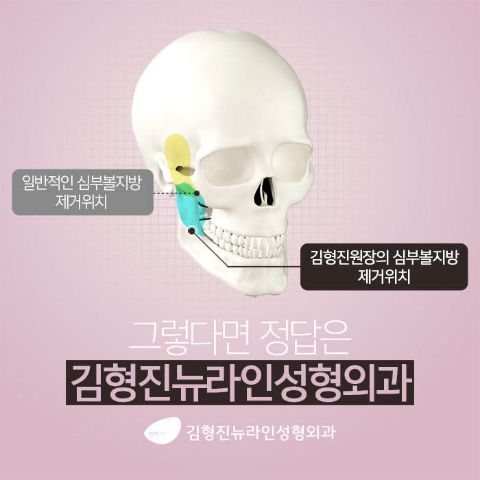 볼씹힘 심하다면, 이게 해결책! 관련 이미지 3