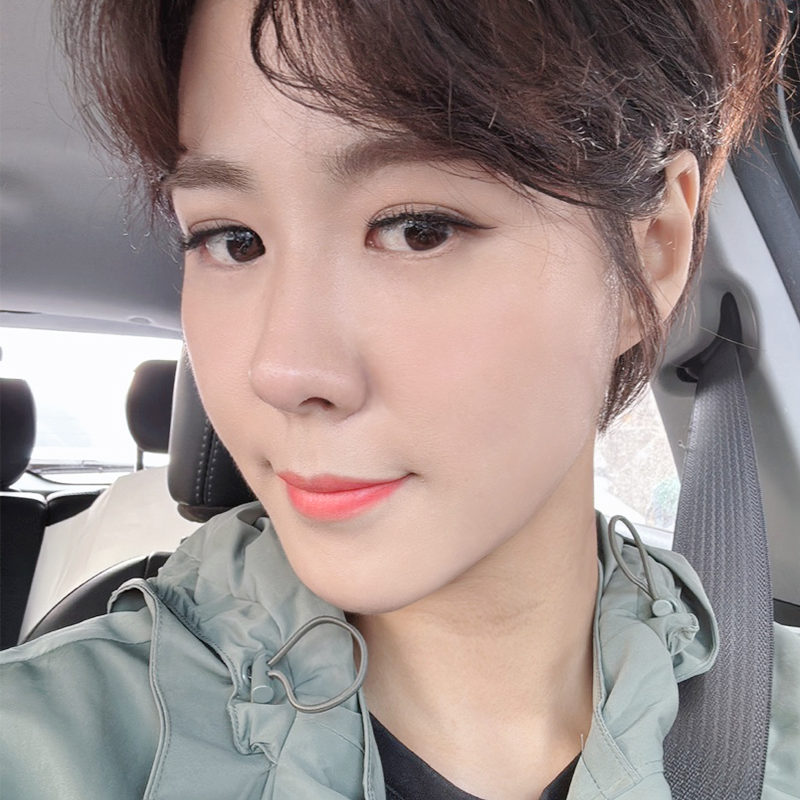 눈밑지방재배치수술 아직도 망설이신다면 관련 이미지 2