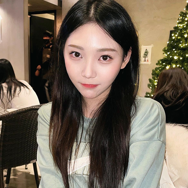 심부볼제거수술 볼살 빼는 확실한 방법인거 모르셨다면! 관련 이미지 4