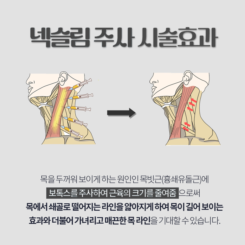 나 빼고 다 한다는 목선관리 받고 왔어요 관련 이미지 4