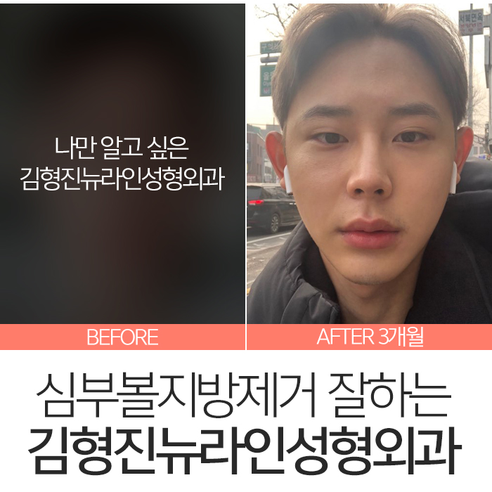 심부볼만 했어요 관련 이미지 7
