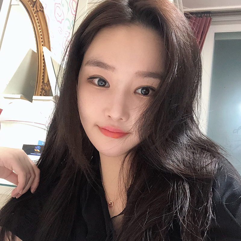 이중턱지방흡입전후 차이가 큰 김형진베이직 관련 이미지 6
