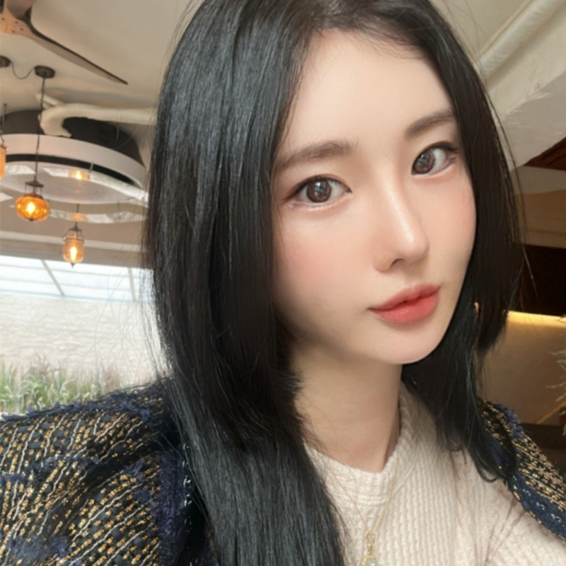 눈밑지방재배치재발 걱정하지 마세요! 관련 이미지 3