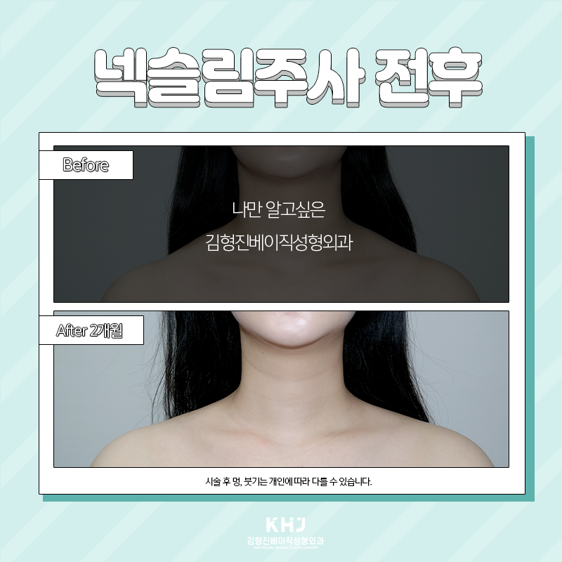 두꺼운목 해결방법 여기 있어요! 관련 이미지 3