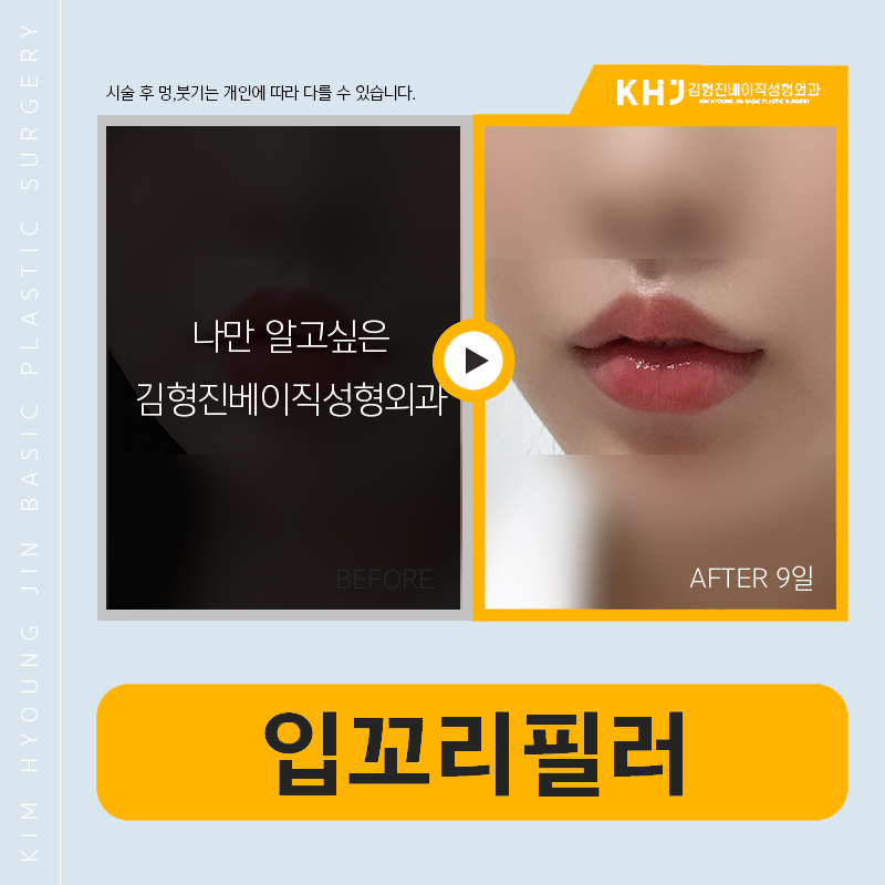 강남입꼬리필러 맛집 찾고 있다면 관련 이미지 5