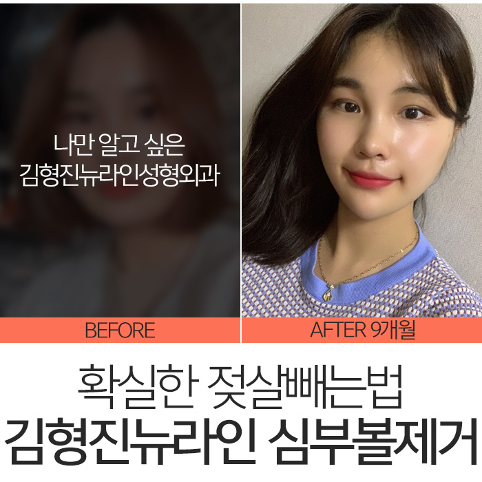 젖살빼는법 따로 있어요 관련 이미지 2