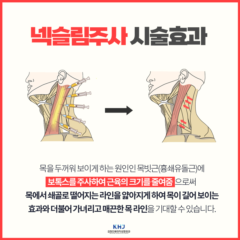 넥슬림주사전후 목부터 어깨까지 더 여리여리하게 관련 이미지 4