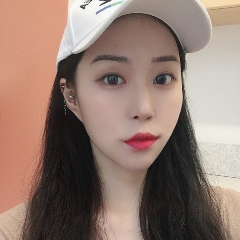 처진 볼살 정리하는 비밀, 심부볼지방제거술로 해결해요! 관련 이미지 2