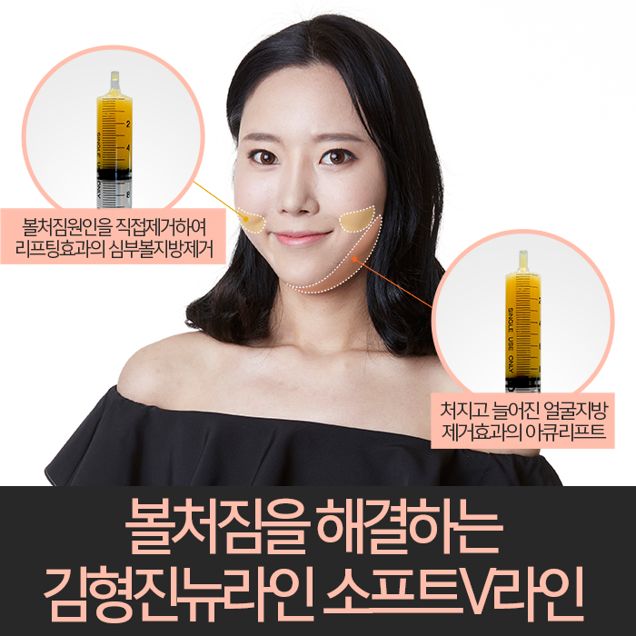 윤곽후볼처짐 해결하려면 관련 이미지 4