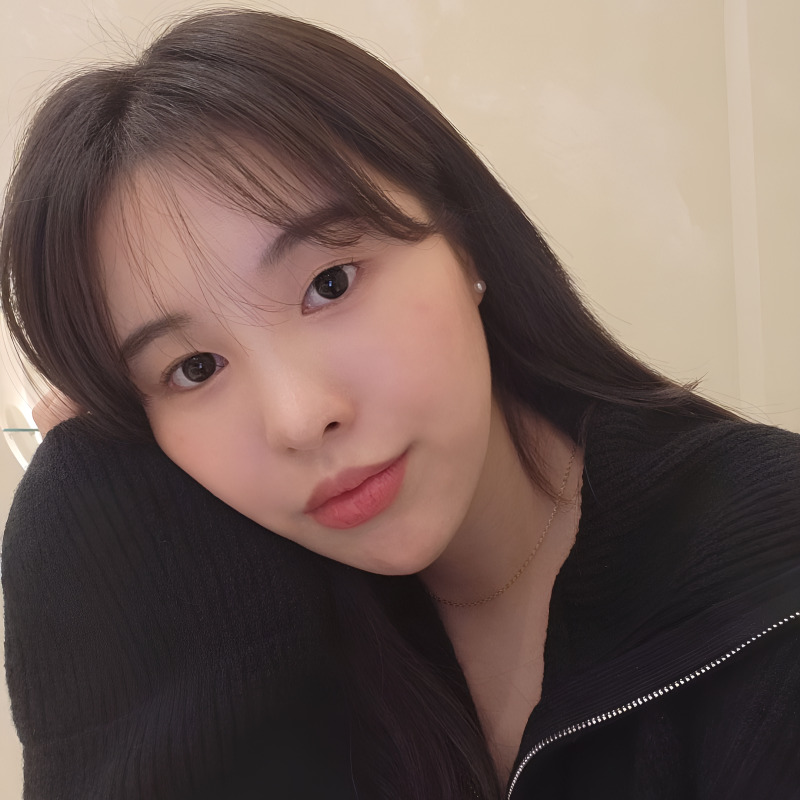 입꼬리필러전후 이보다 다를 수가 있나요? 관련 이미지 2