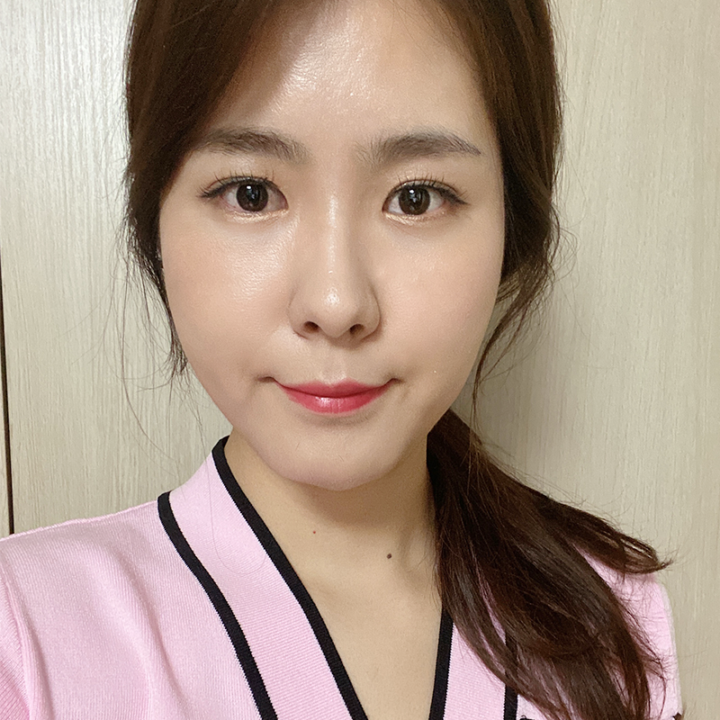 눈밑지방재배치재발 걱정 없는 이유 관련 이미지 2