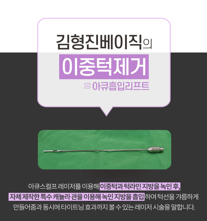 턱라인지방흡입 부담 없는 가격이죠 관련 이미지 5
