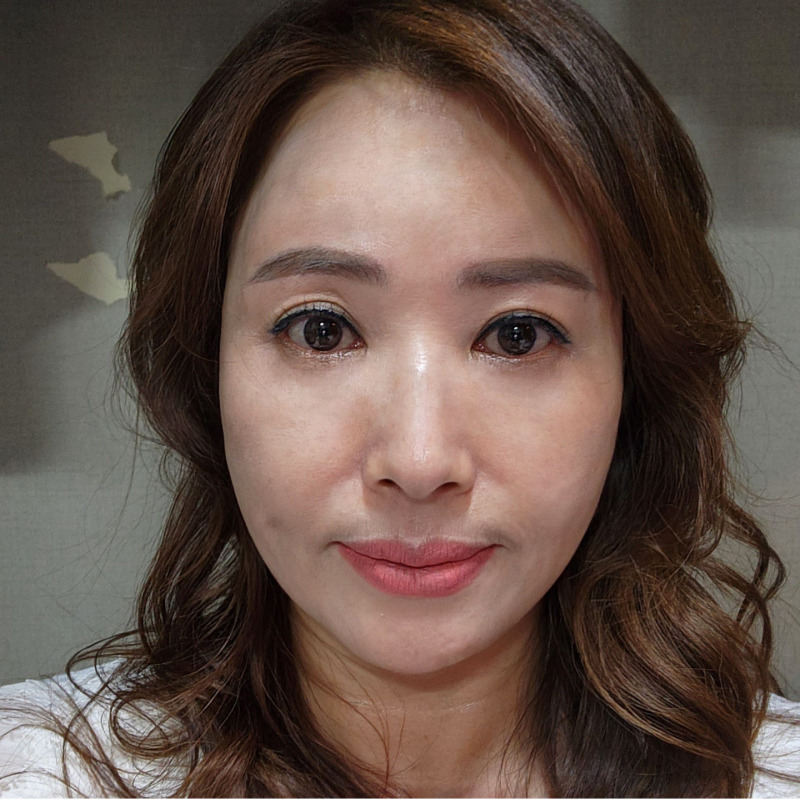 효도성형으로 젊음을 되찾아드리고 싶다면? 관련 이미지 1