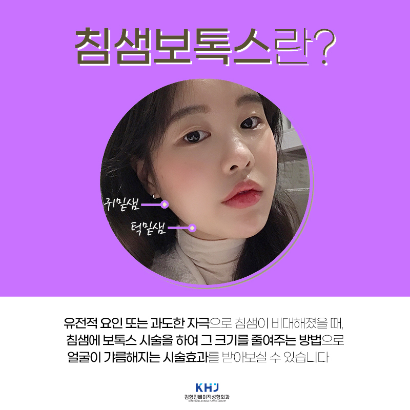 압구정침샘보톡스로 둔해 보이는 턱 선을 갸름하게 관련 이미지 4