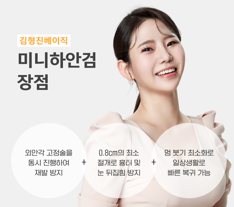미니하안검재수술 발생 확률 적은 김형진베이직 관련 이미지 3