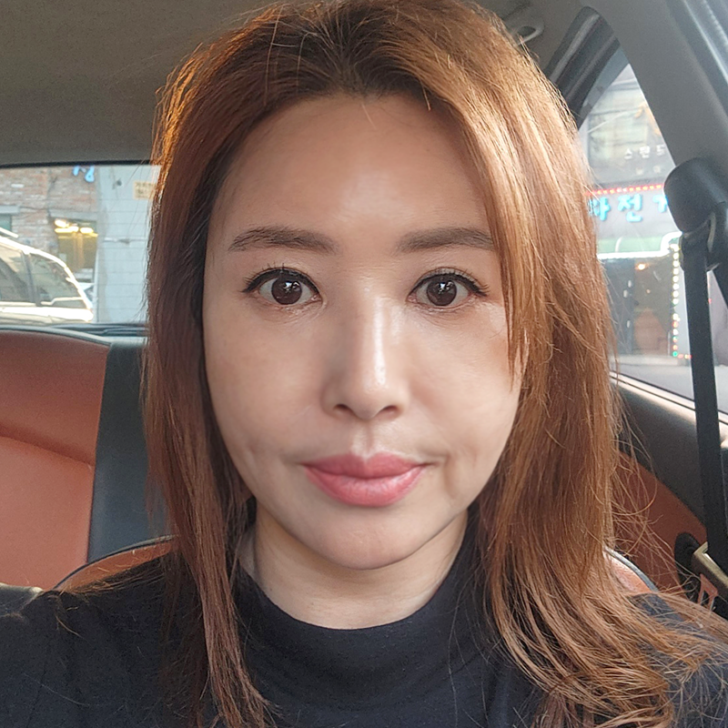 미니하안검붓기 궁금하셨다구요? 관련 이미지 1