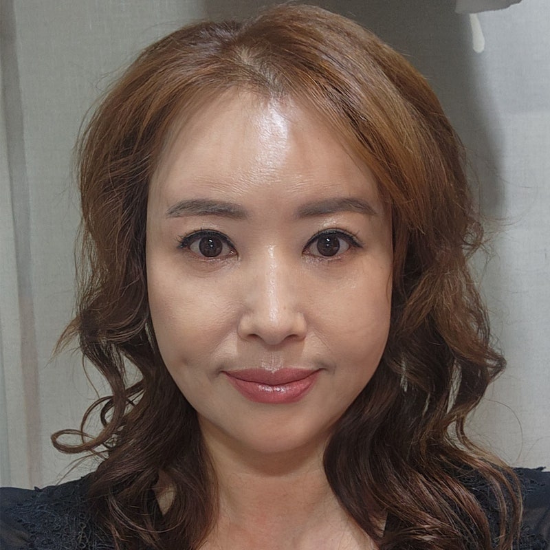 미니하안검효과 궁금하시다구요? 관련 이미지 1