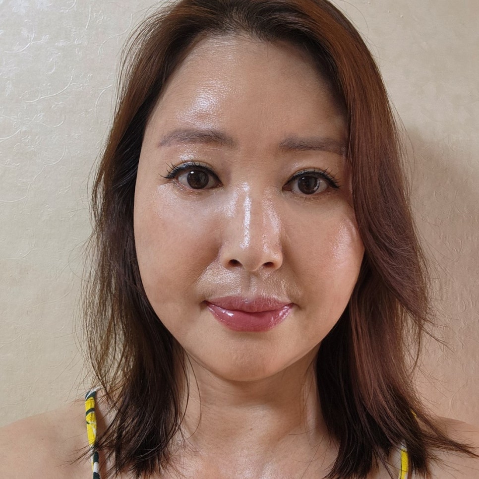 Mini Lower Eyelid Surgery Review: When the area under the eyes brightens, you really do look younger image 2