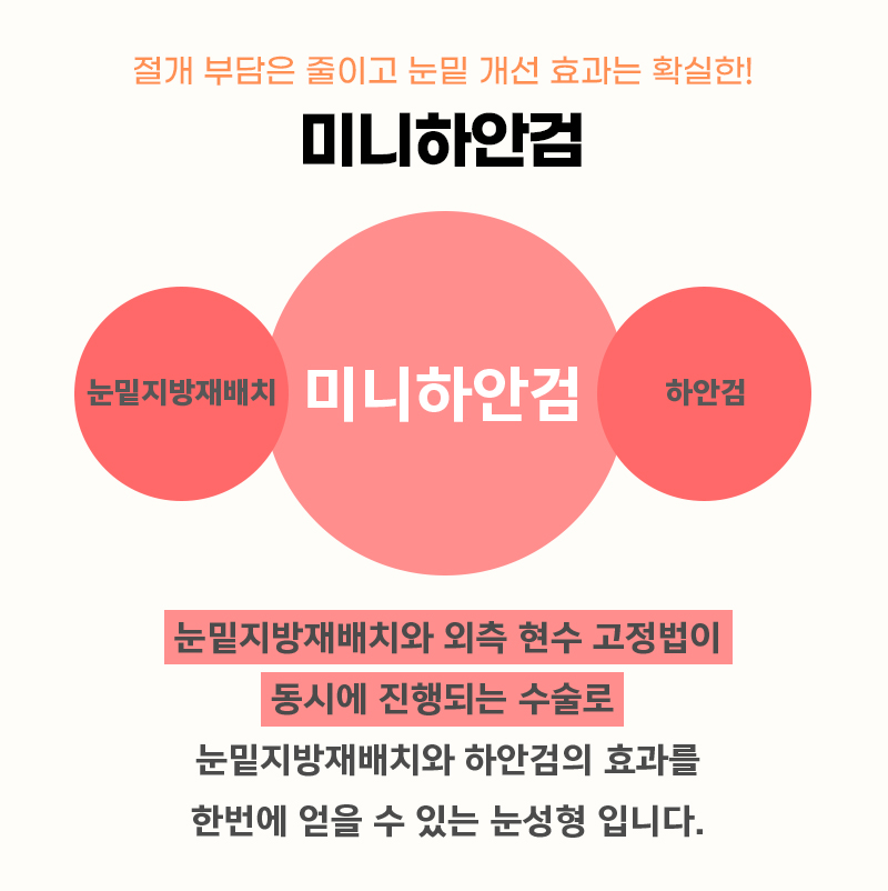 혹시 미니하안검비용 때문에 망설이고 계셨다면 관련 이미지 3