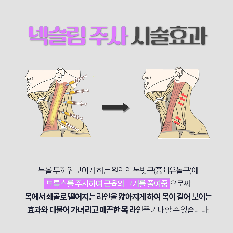 넥슬림주사, 두꺼운목을 완전 슬림하게 관련 이미지 3