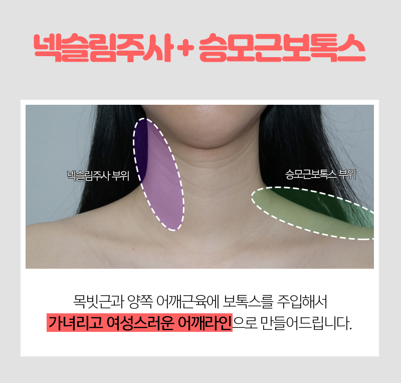 예비신부관리 시작해보자구요! 관련 이미지 5