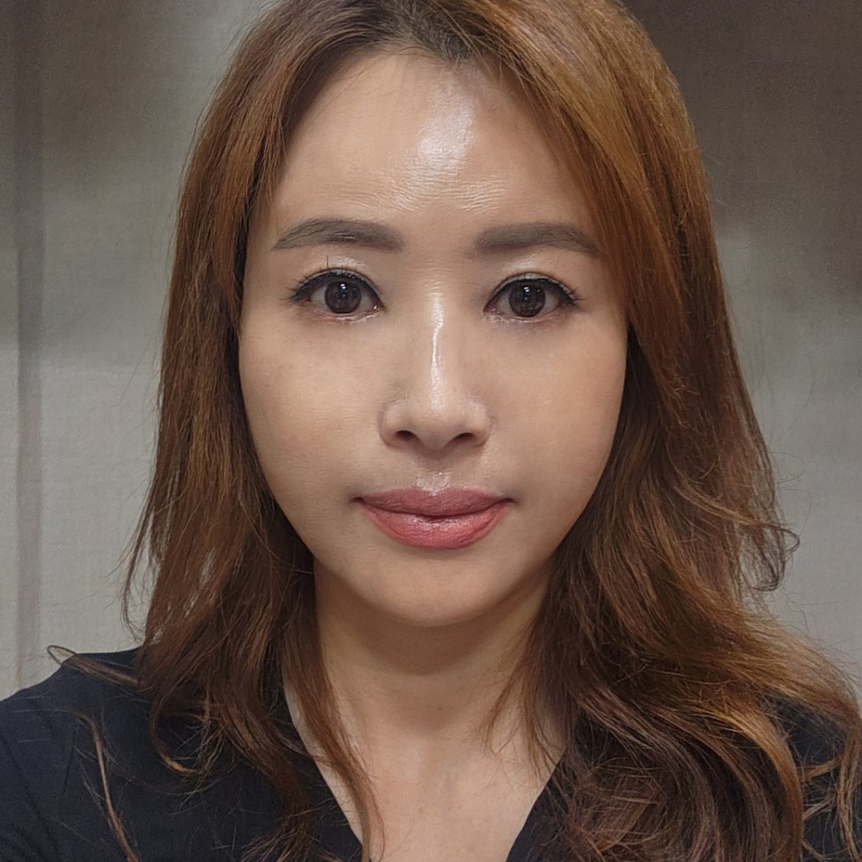 눈 밑 처짐, 미니하안검수술로 이제 가볍게 해결해요 관련 이미지 1