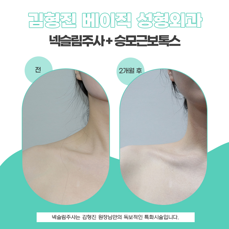 압구정넥슬림주사의 원조는 김형진베이직 뿐입니다 관련 이미지 5