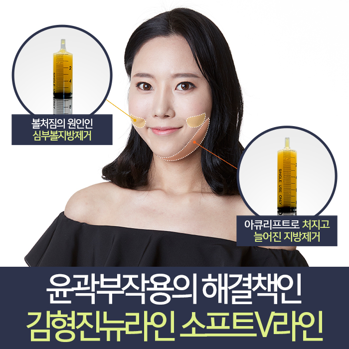 윤곽부작용 해결책 있어요 있어! 관련 이미지 4