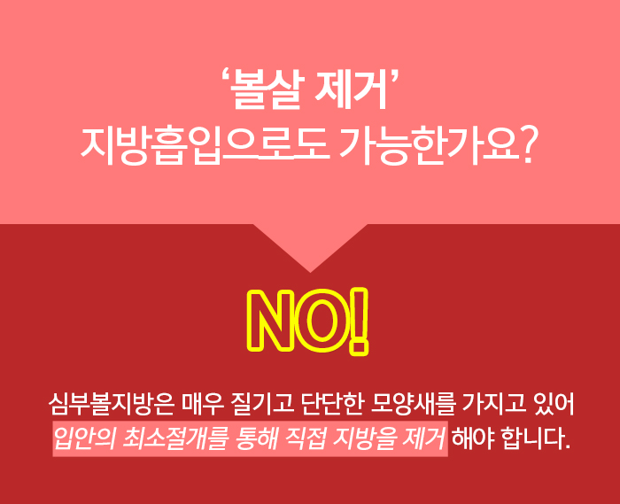 볼살제거하는방법 지방흡입이 답이 아니에요! 관련 이미지 2