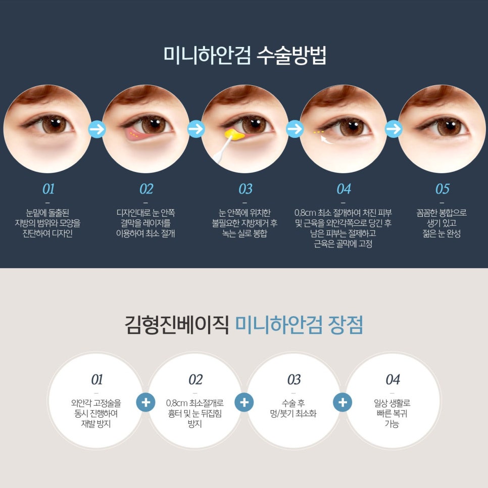 눈밑처짐수술 고민해결하고 동안소리 들어요 관련 이미지 5