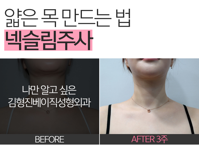 신부관리 이건 절대 빠질 수 없죠 관련 이미지 4