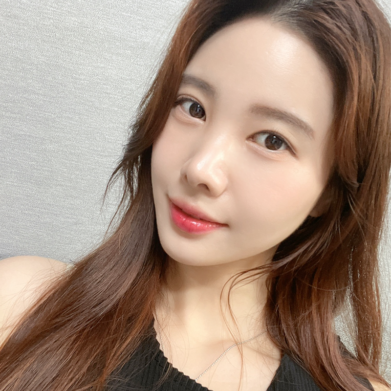 얼굴지방흡입방법 궁금하셨다면? 관련 이미지 1