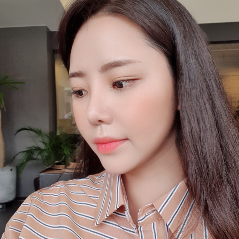 침샘보톡스시술주기 어떻게 될까요? 관련 이미지 3