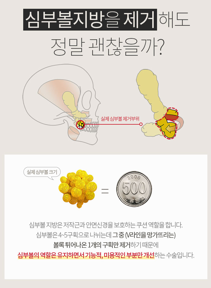 불독살 제거는 이 방법 뿐★ 관련 이미지 5
