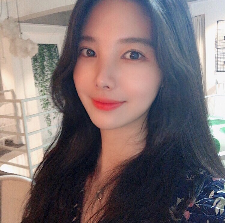 입꼬리필러붓기 별 거 아니죠! 관련 이미지 1