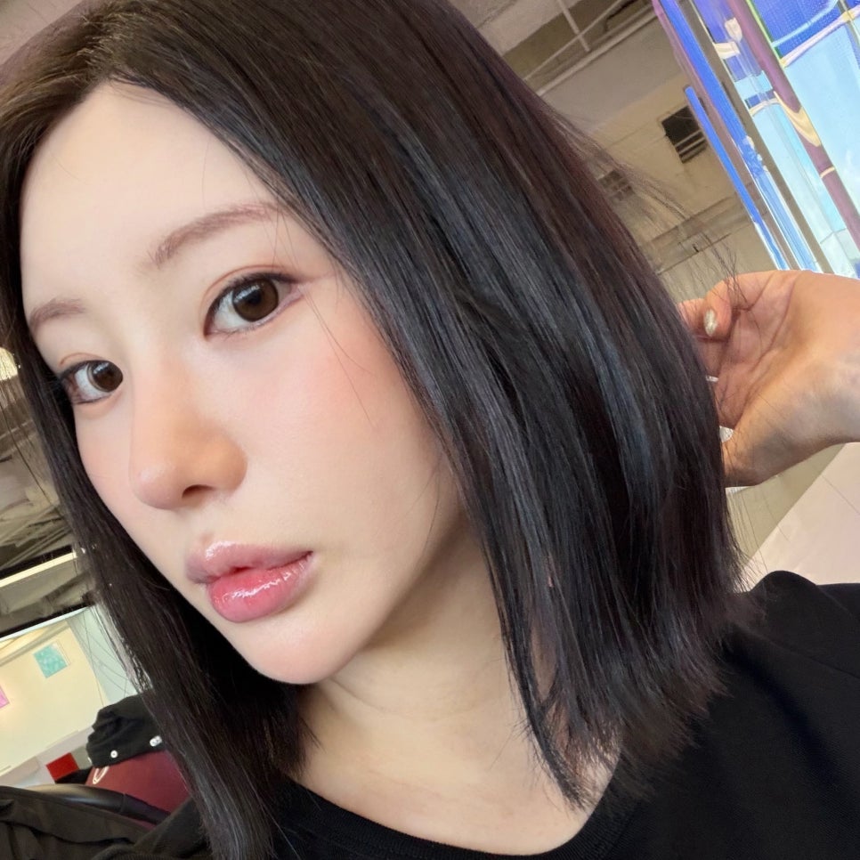 심부볼지방제거로 얼굴형 고민 해결했어요! 관련 이미지 3