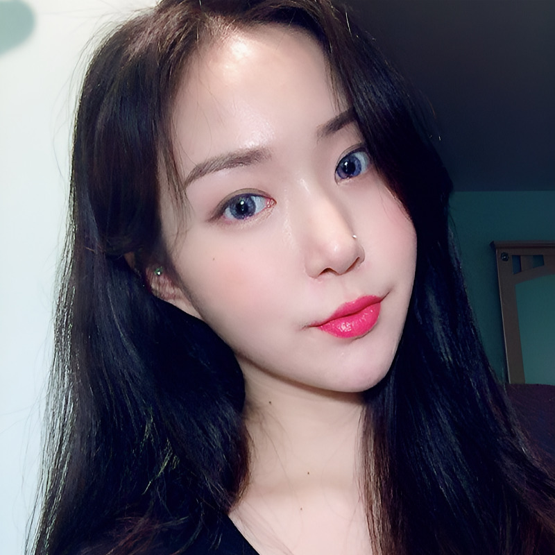 심부볼제거수술 볼패임 없이 할 수 있는 곳? 관련 이미지 2