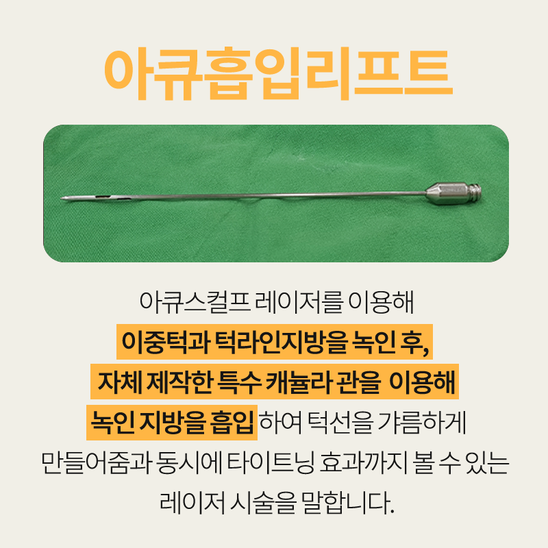 이중턱지방흡입전후 보고 가세요! 관련 이미지 3