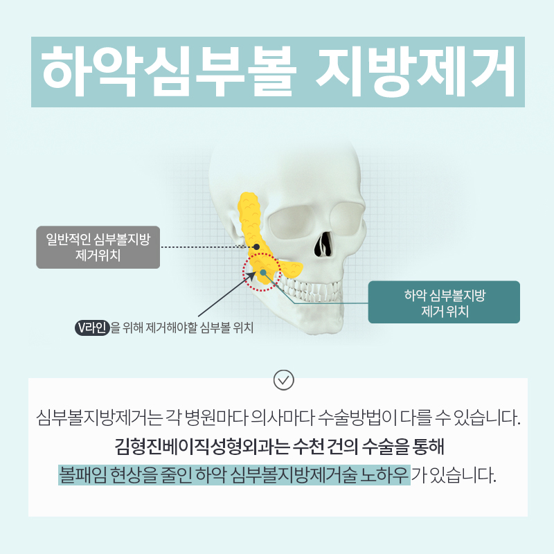 왜 하악심부볼이냐면요. 관련 이미지 2
