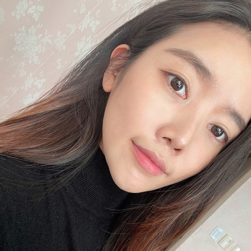 얼굴지방흡입처짐 걱정하시고계세요? 관련 이미지 5